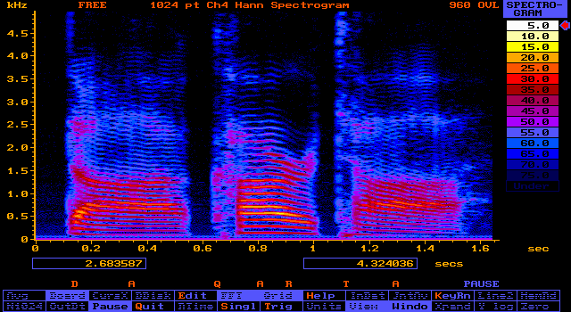 [Speech Spectrogram (32K image)]